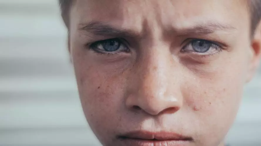 Face of a maltreated child 